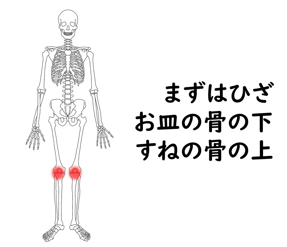 成長期に特有の痛み・骨端症が起こりやすい場所は、まずは「ひざ」です。膝のお皿の下端、そしてスネの骨の上端です