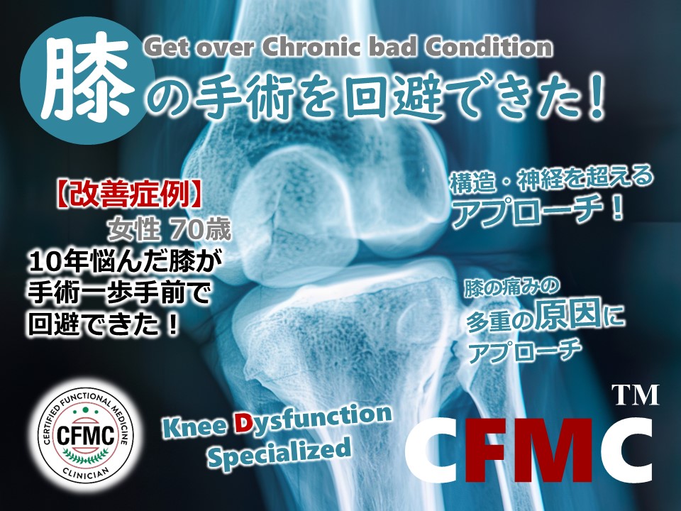 10年苦しんだ手術手前の難治の膝痛が見事に改善！